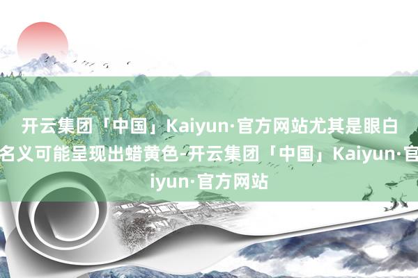 开云集团「中国」Kaiyun·官方网站尤其是眼白和皮肤名义可能呈现出蜡黄色-开云集团「中国」Kaiyun·官方网站